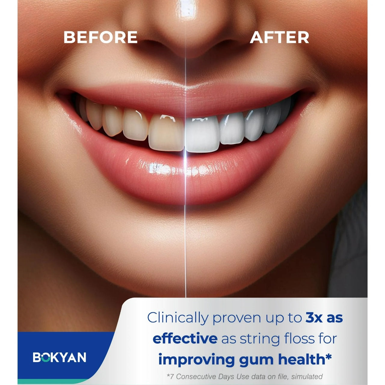 ORAL IRRIGATOR WATER FLOSSER