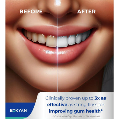 ORAL IRRIGATOR WATER FLOSSER